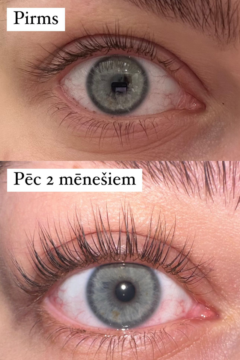 Skropstu Augšanas Serums