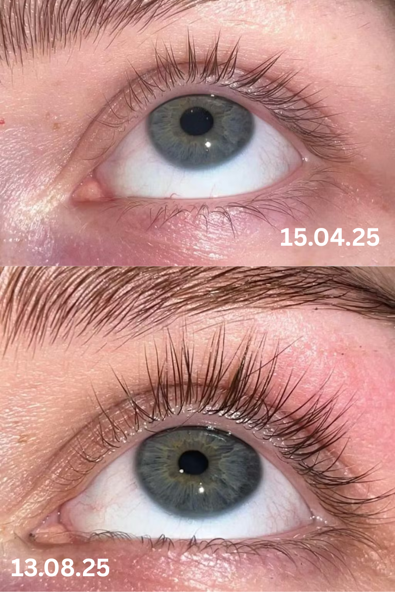 Skropstu Augšanas Serums