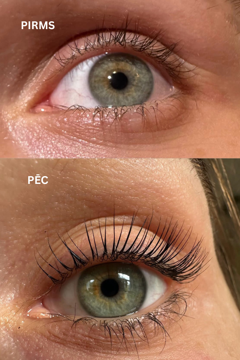 Skropstu Augšanas Serums