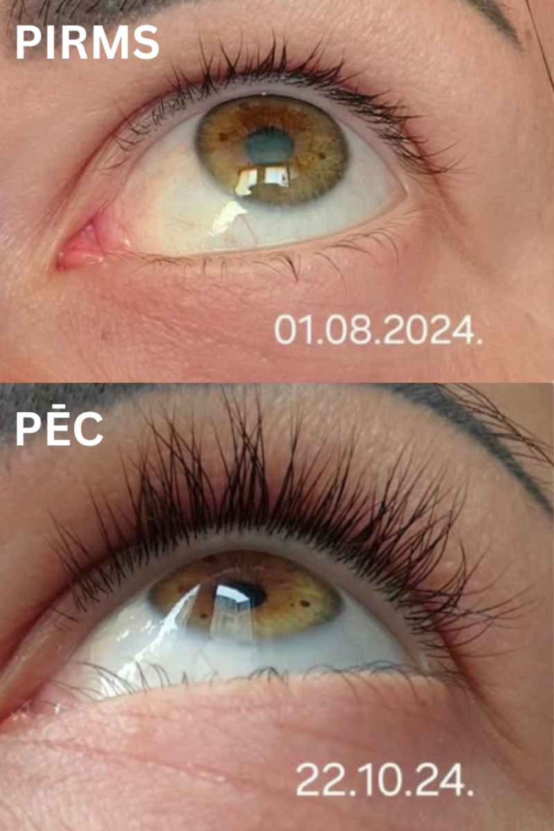 DOUBLE Skropstu Augšanas Serums
