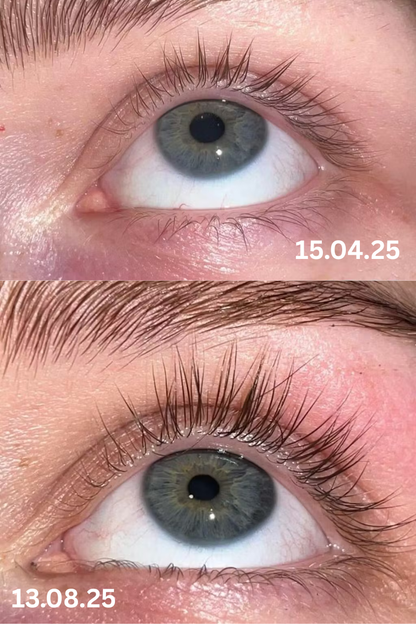 Skropstu Augšanas Serums